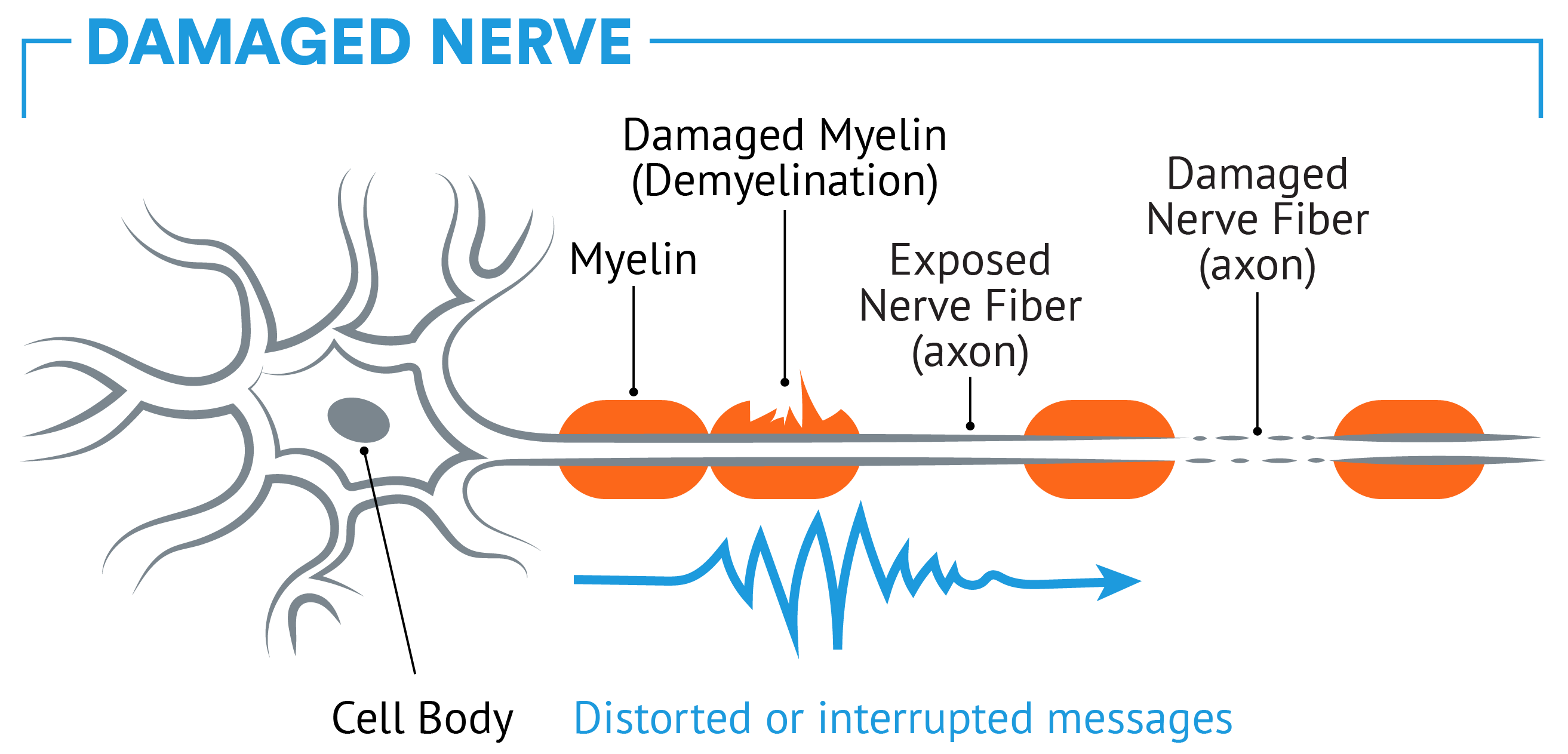 Healthy nerve vs. damaged nerve in CNS